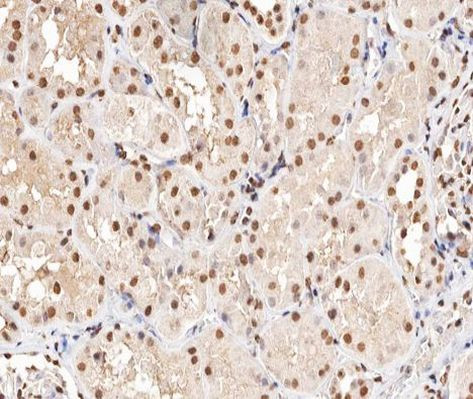 Phospho-PRAK (Thr182) Antibody in Immunohistochemistry (Paraffin) (IHC (P))
