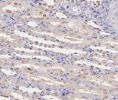 Phospho-PRAK (Thr182) Antibody in Immunohistochemistry (Paraffin) (IHC (P))