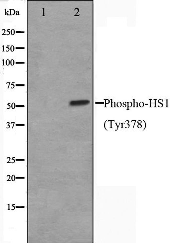 Phospho-HCLS1 (Tyr378) Antibody in Western Blot (WB)