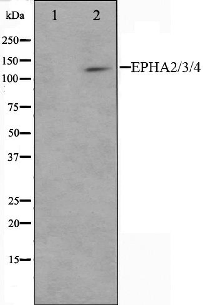 EphA2/EphA3/EphA4 Antibody in Western Blot (WB)