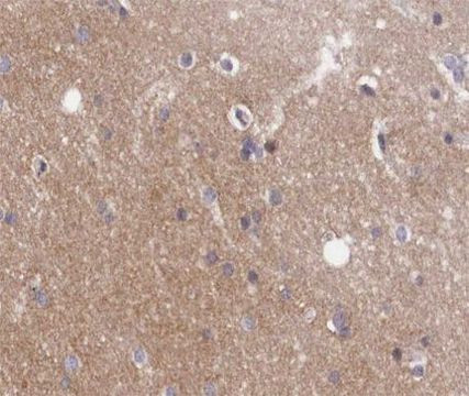 GNAZ Antibody in Immunohistochemistry (Paraffin) (IHC (P))
