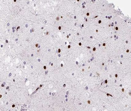 hnRNP D Antibody in Immunohistochemistry (Paraffin) (IHC (P))