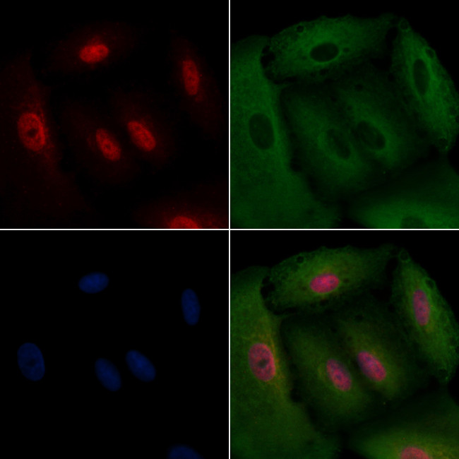 Cyclin G1 Antibody in Immunocytochemistry (ICC/IF)