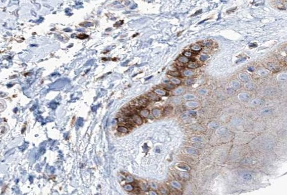 Cytokeratin 16 Antibody in Immunohistochemistry (Paraffin) (IHC (P))