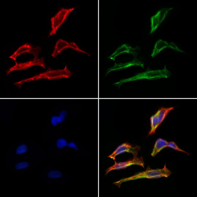 MMP15 Antibody in Immunocytochemistry (ICC/IF)