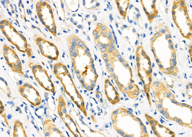 NME2 Antibody in Immunohistochemistry (Paraffin) (IHC (P))