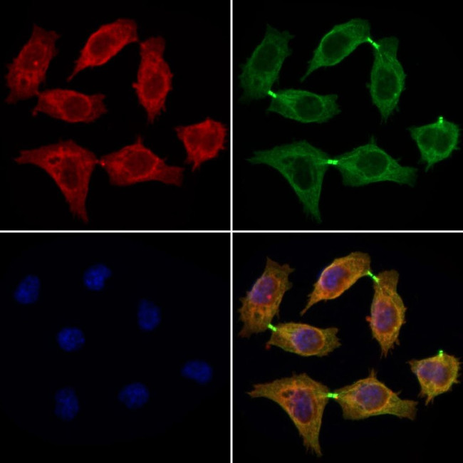 DCTN2 Antibody in Immunocytochemistry (ICC/IF)