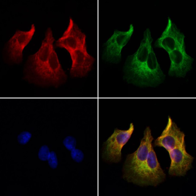 PTH Antibody in Immunocytochemistry (ICC/IF)