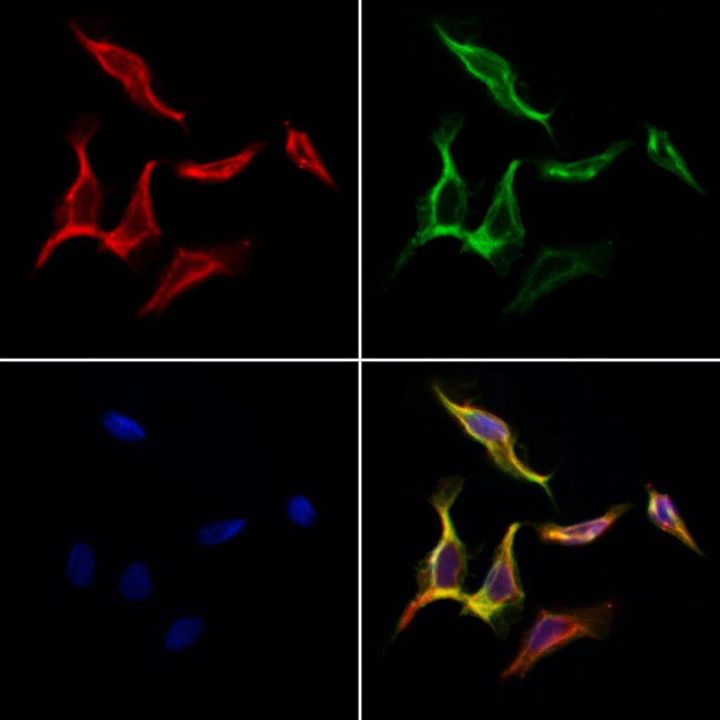 KV3.2 (KCNC2) Antibody in Immunocytochemistry (ICC/IF)