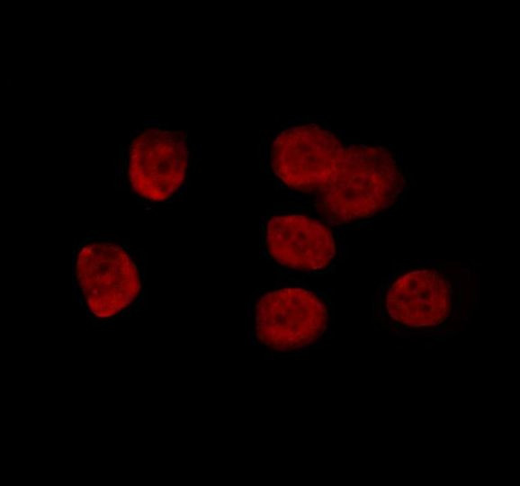 RCBTB1 Antibody in Immunocytochemistry (ICC/IF)