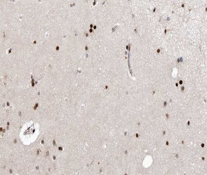CDK7 Antibody in Immunohistochemistry (Paraffin) (IHC (P))