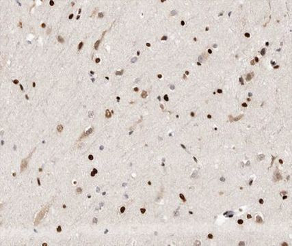HYD Antibody in Immunohistochemistry (Paraffin) (IHC (P))