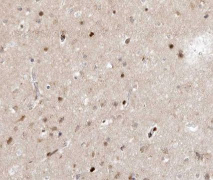 SENP7 Antibody in Immunohistochemistry (Paraffin) (IHC (P))