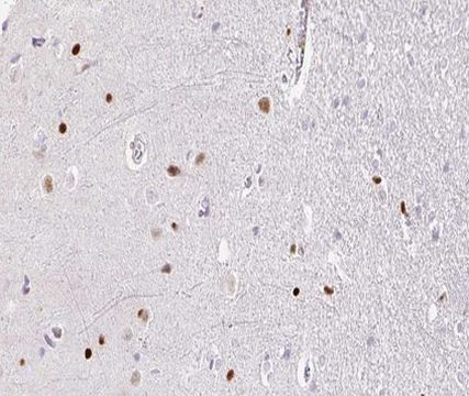 TOP2B Antibody in Immunohistochemistry (Paraffin) (IHC (P))