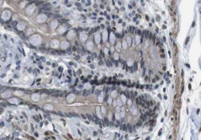 ANO9 Antibody in Immunohistochemistry (Paraffin) (IHC (P))