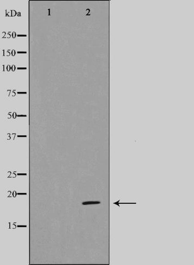 CDK2AP1 Antibody in Western Blot (WB)