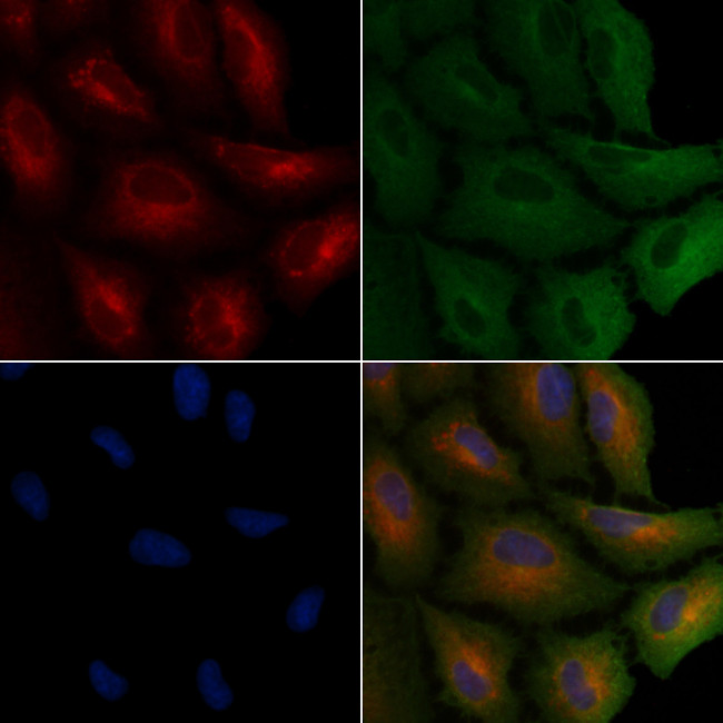 TP53I11 Antibody in Immunocytochemistry (ICC/IF)