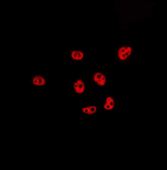 KLF11 Antibody in Immunocytochemistry (ICC/IF)