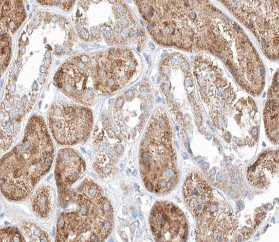 MID1 Antibody in Immunohistochemistry (Paraffin) (IHC (P))