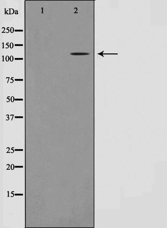 ST18 Antibody in Western Blot (WB)