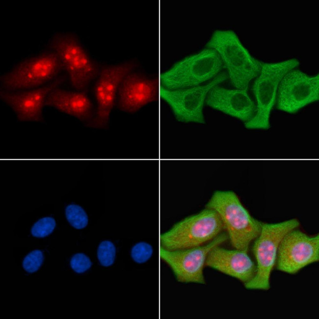 TBX10 Antibody in Immunocytochemistry (ICC/IF)