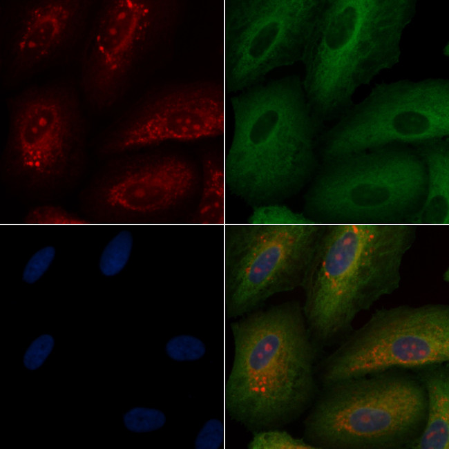 Thrombin Antibody in Immunocytochemistry (ICC/IF)