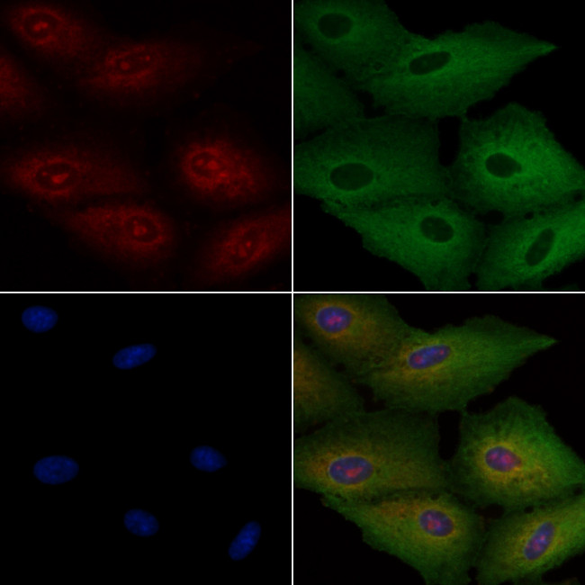 TSPAN8 Antibody in Immunocytochemistry (ICC/IF)