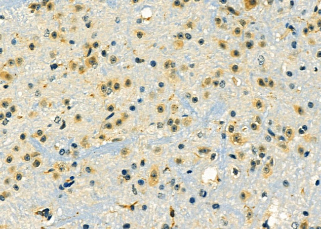 ZNF436 Antibody in Immunohistochemistry (Paraffin) (IHC (P))