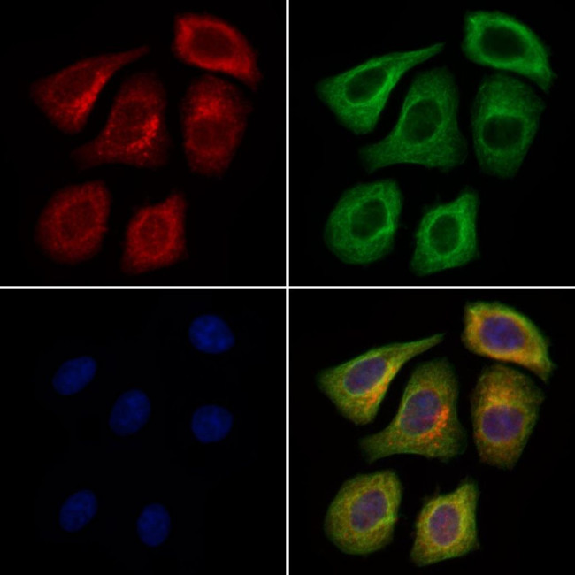 Fibrillin 1 Antibody in Immunocytochemistry (ICC/IF)