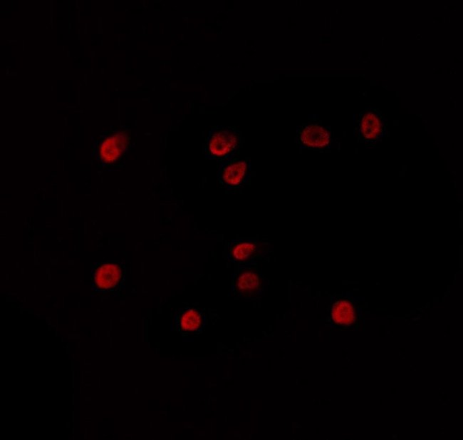 ZNF498 Antibody in Immunocytochemistry (ICC/IF)