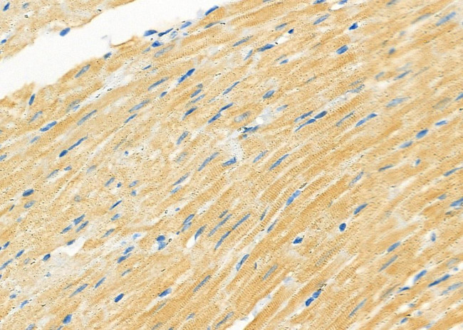 MN1 Antibody in Immunohistochemistry (Paraffin) (IHC (P))