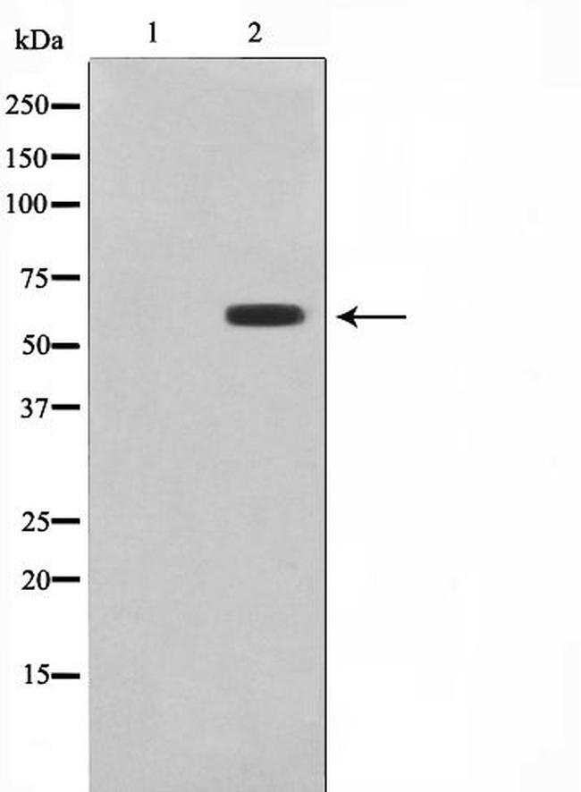 CYP26A1 Antibody in Western Blot (WB)