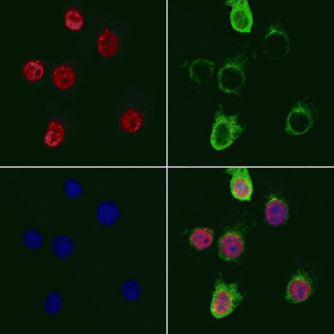 SUPT3H Antibody in Immunocytochemistry (ICC/IF)