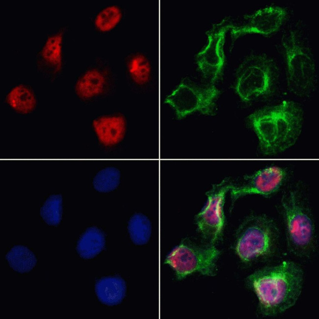 VPS72 Antibody in Immunocytochemistry (ICC/IF)
