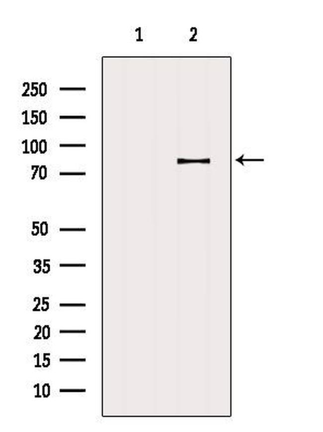 ZNF225 Antibody in Western Blot (WB)