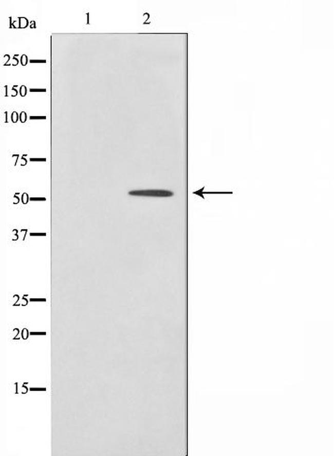 HNF4A/HNF4G Antibody in Western Blot (WB)