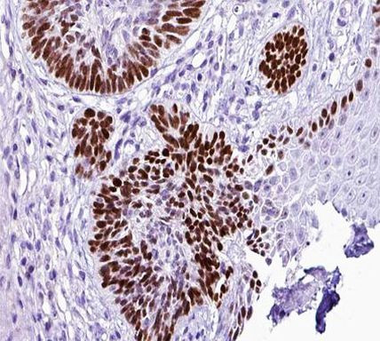 AP2 alpha/beta Antibody in Immunohistochemistry (Paraffin) (IHC (P))