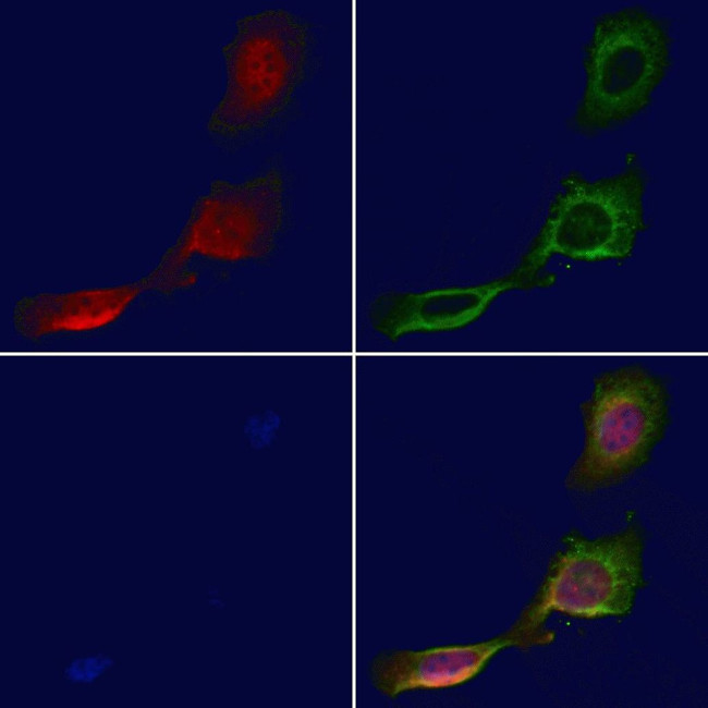 DCP1A Antibody in Immunocytochemistry (ICC/IF)