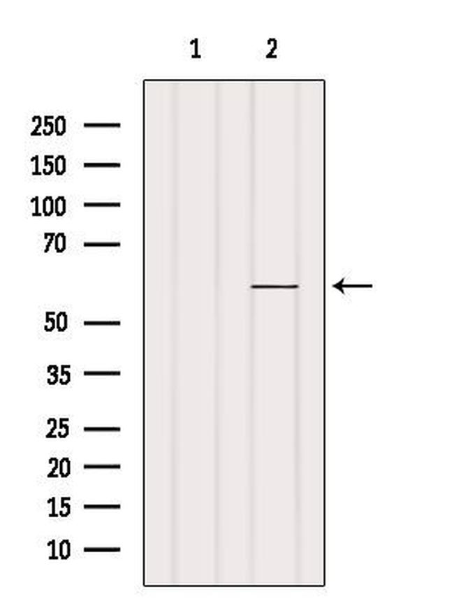ZNF682 Antibody in Western Blot (WB)