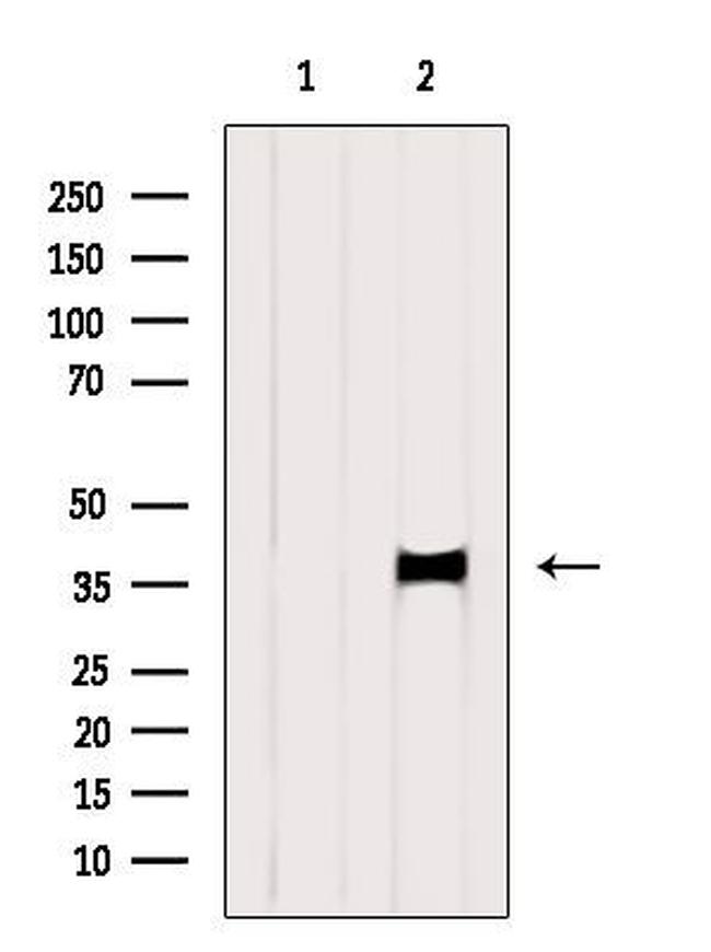 PRDM12 Antibody in Western Blot (WB)