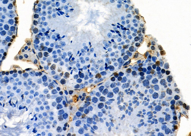 PKNOX2 Antibody in Immunohistochemistry (Paraffin) (IHC (P))