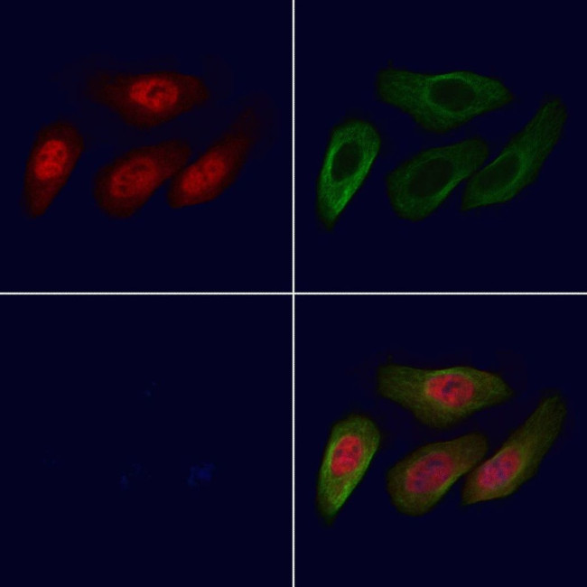 LYK5 Antibody in Immunocytochemistry (ICC/IF)