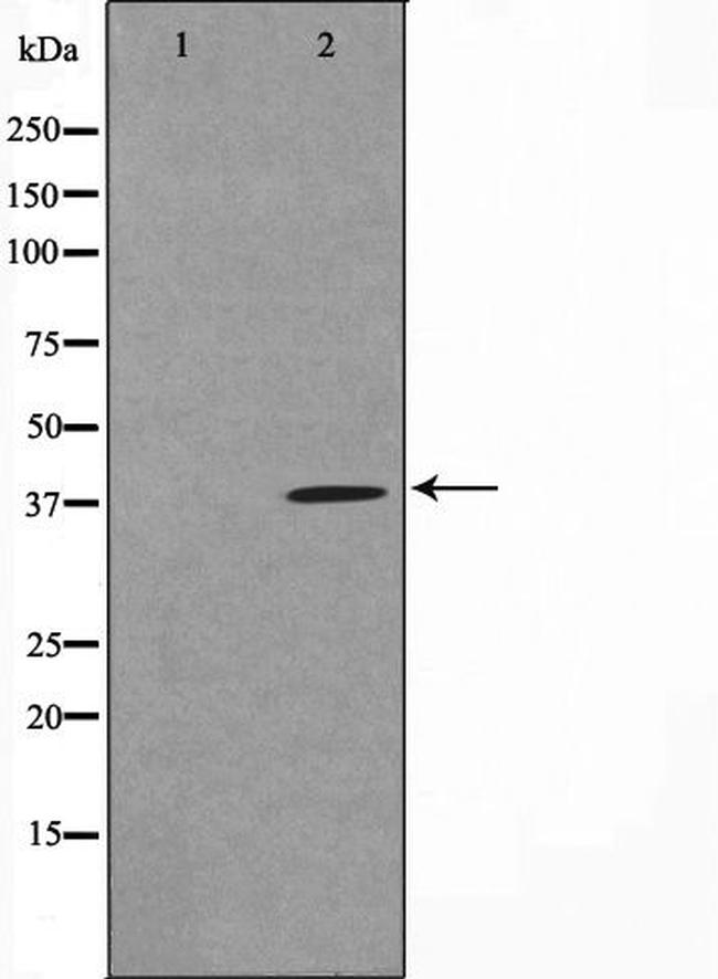 TUSC3 Antibody in Western Blot (WB)