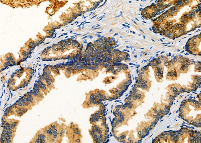 MLK4 Antibody in Immunohistochemistry (Paraffin) (IHC (P))