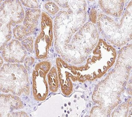 NRIP2 Antibody in Immunohistochemistry (Paraffin) (IHC (P))