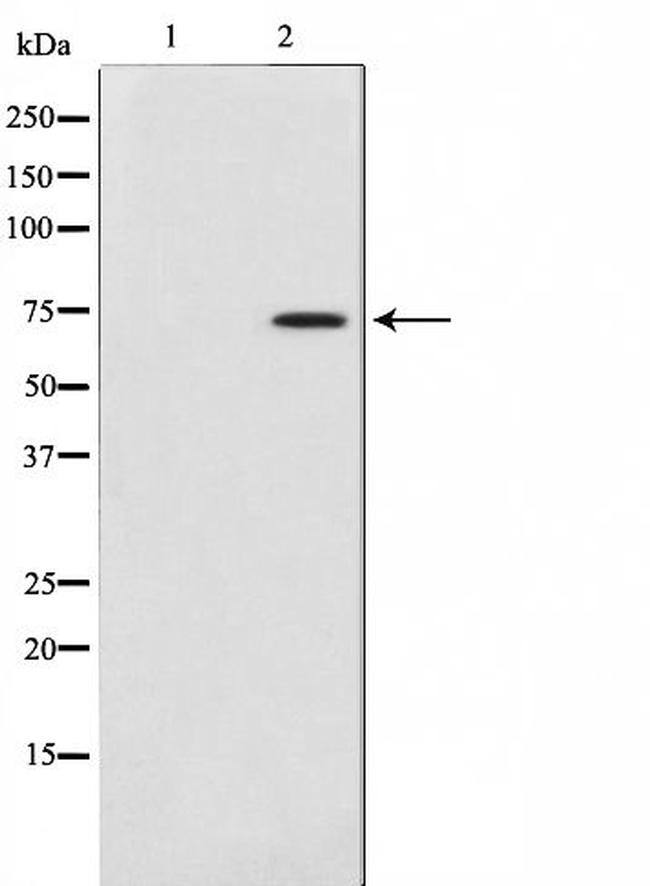 COL13A1 Antibody in Western Blot (WB)