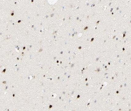 FOXJ3 Antibody in Immunohistochemistry (Paraffin) (IHC (P))