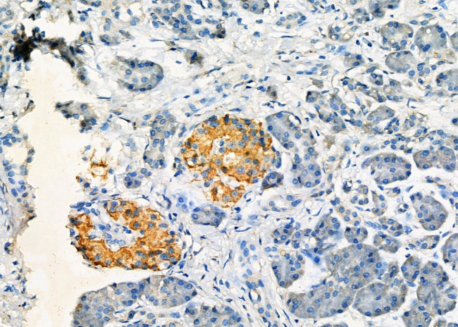 AKAP14 Antibody in Immunohistochemistry (Paraffin) (IHC (P))