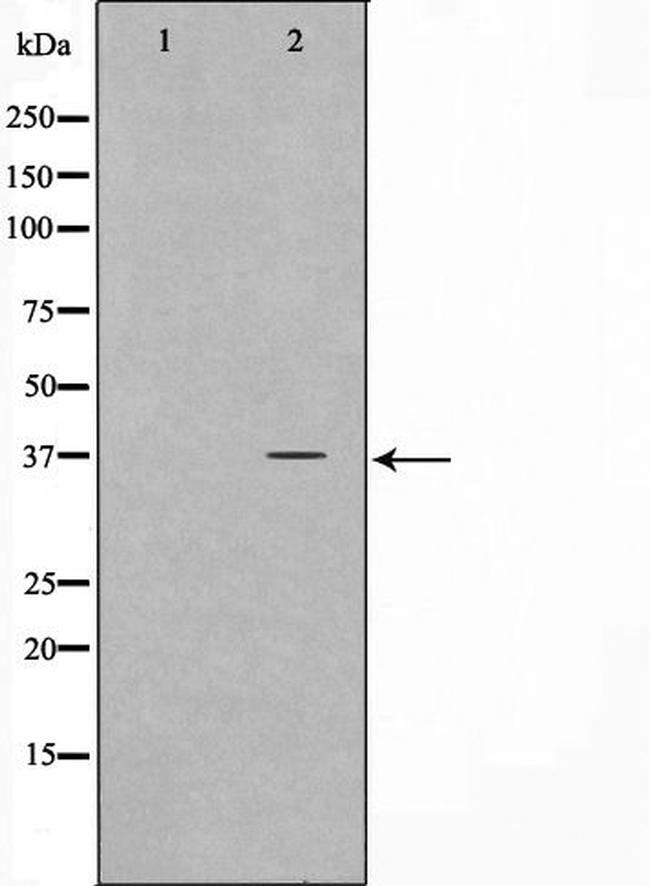 ELOVL4 Antibody in Western Blot (WB)