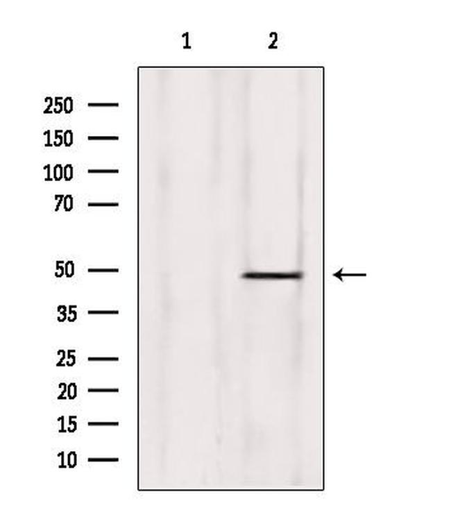 ZNF174 Antibody in Western Blot (WB)